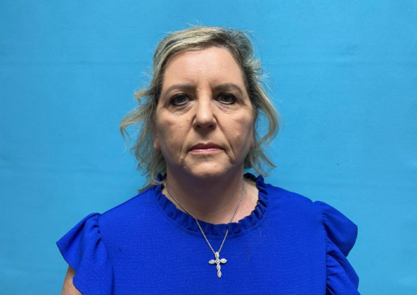 Facelift Case 9 - After