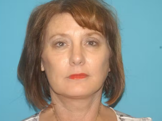 Facelift Case 17 - After