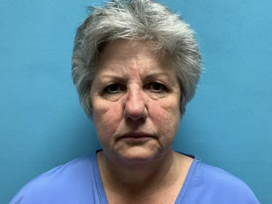 Facelift Case 10 - Before