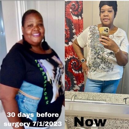 Patient Transformation Stories: Nina