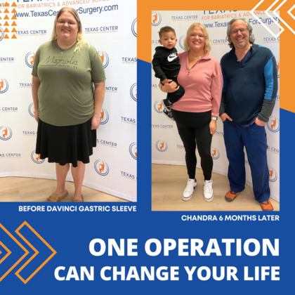 Patient Transformation Stories: Chandra