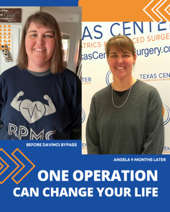 Patient Transformation Stories: Angela 9 Months after Gastric Bypass! - After