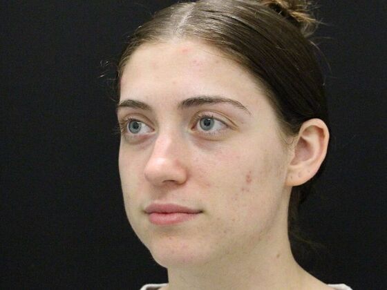 Rhinoplasty: Case 4 - Before