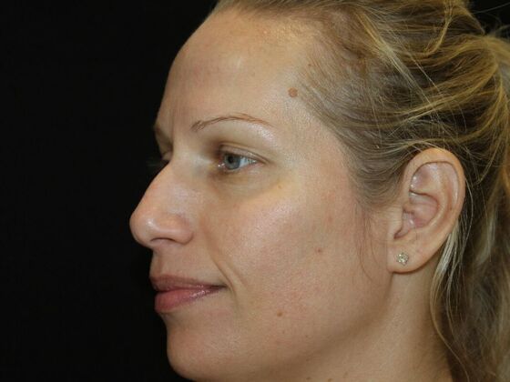 Skin Treatments: Case 16 - Before