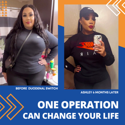 Patient Transformation Stories: Ashley