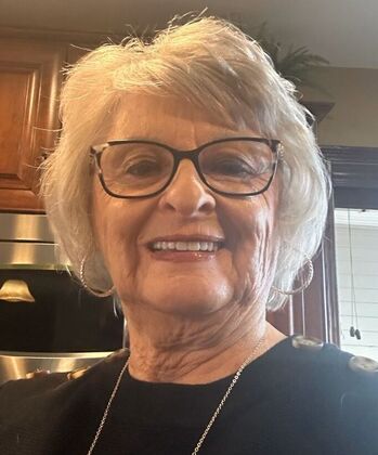 Dental Implants Case 8 - After