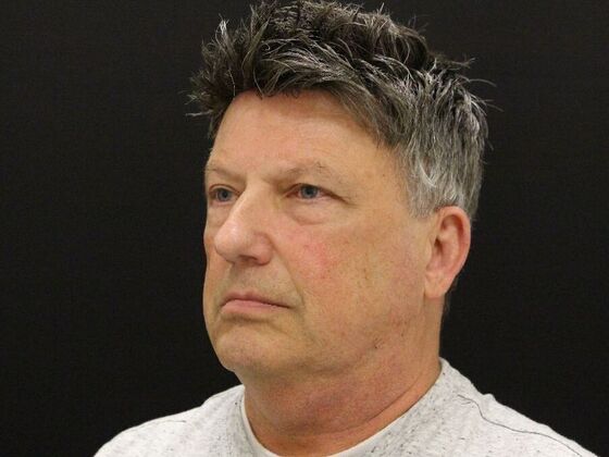 Face & Neck Lifts: Case 52 - Before