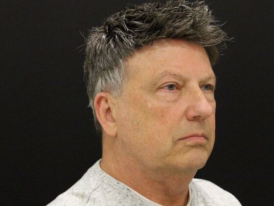 Face & Neck Lifts: Case 52 - Before