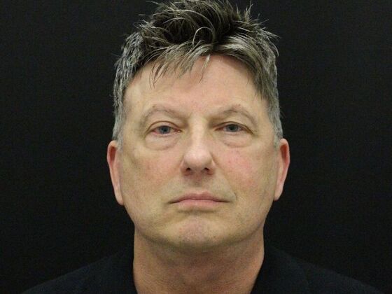 Face & Neck Lifts Case 52 - After