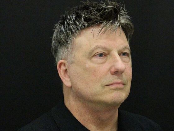 Face & Neck Lifts: Case 52 - After