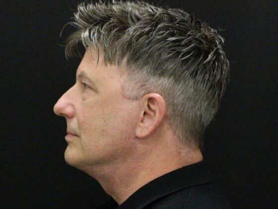 Face & Neck Lifts: Case 52 - After