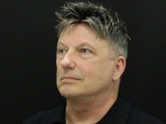 Face & Neck Lifts: Case 52 - After