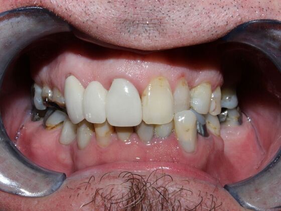 Before and Afters Brian  - Before