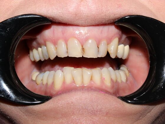 Before and Afters Carletta C - Before