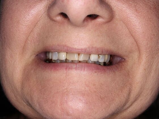 Before and Afters: Darlene - Before