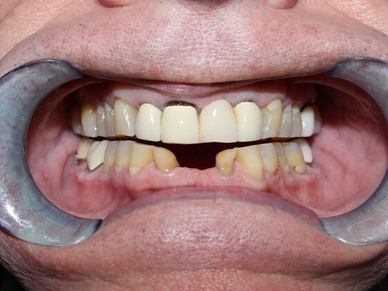 Before and Afters Ken T - Before