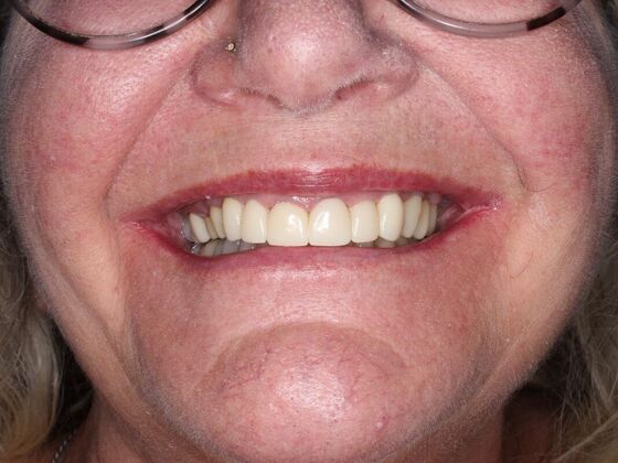 Before and Afters Marty - After