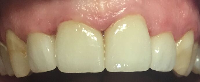 Before and Afters Robert  - After