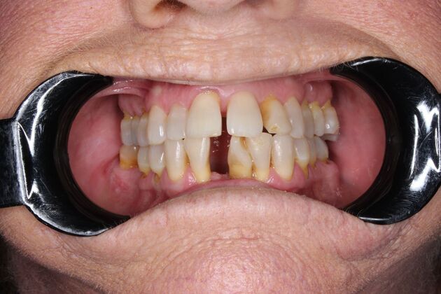 Before and Afters: Robin - Before