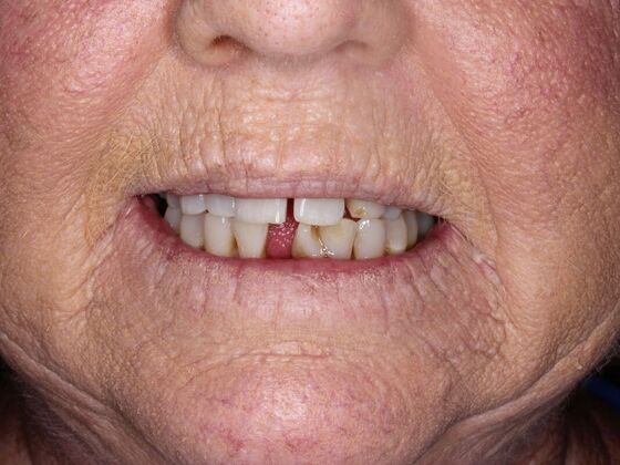 Before and Afters Robin - Before