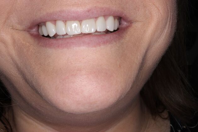 Before and Afters: Sharon - After