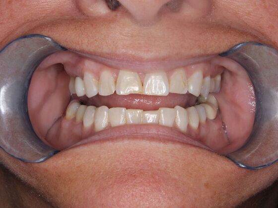 Before and Afters Sharon - Before