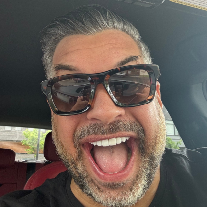 No Prep Porcelain Veneers Robert - After