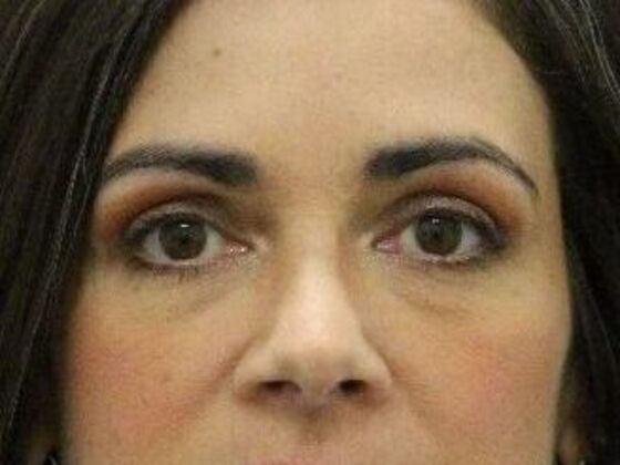 Eyelid Surgery Case 20 - After