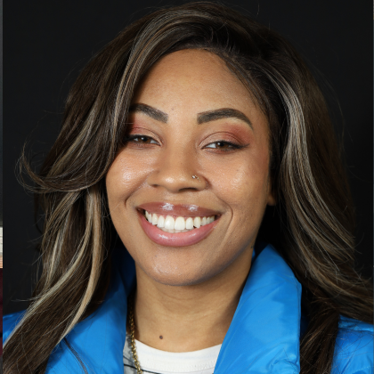 Minimal Prep Porcelain Veneers Ashley - After