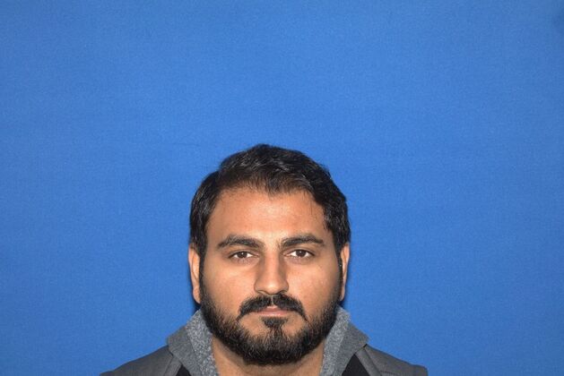 Hair Transplants: Case 4 - Beard and Scalp FUE Hair Transplant - After