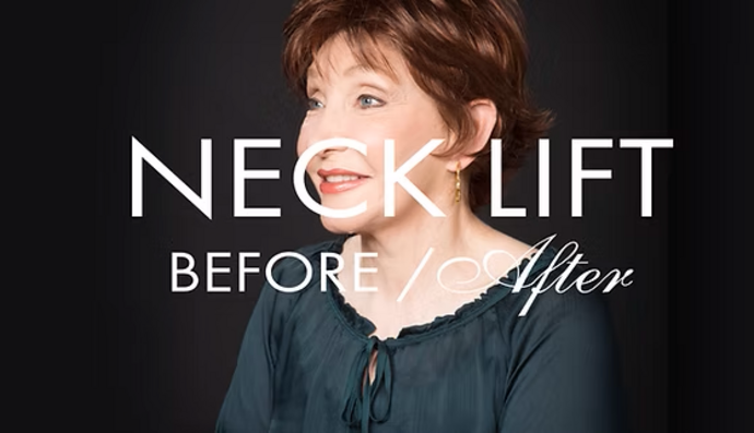 Neck Lift Cases