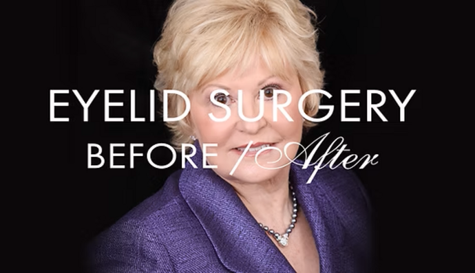 Eyelid Surgery Cases