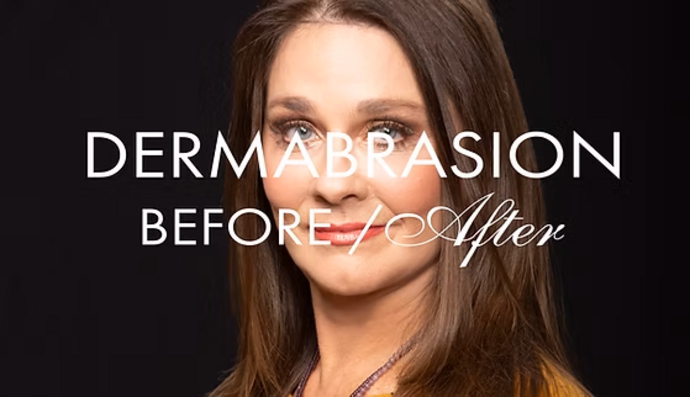Dermabrasion Cases