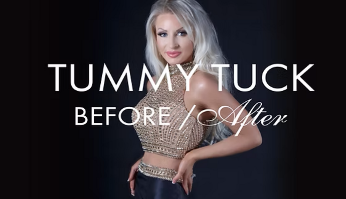 Tummy Tuck Cases