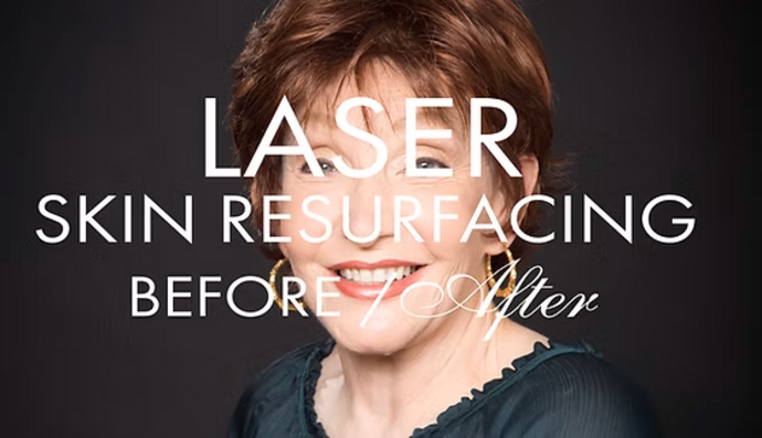 Laser Skin Resurfacing Cases