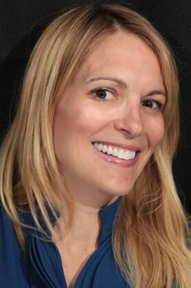 Veneers: Shawna - After