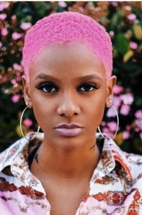 Veneers: Tiara - After