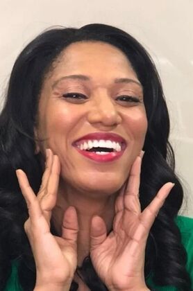 Full Mouth Reconstruction: Natasha - After