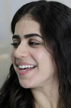 Invisalign: Alicia - After