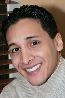 Smile Makeover: Nick - After