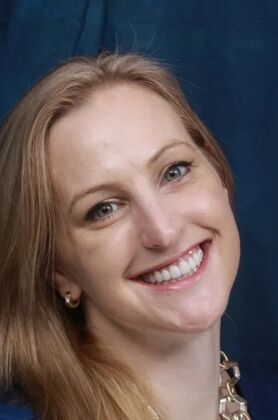 Veneers: Ann - After