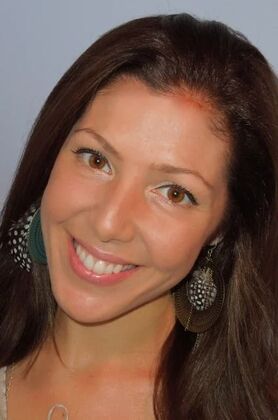 Gum Contouring: Amanda - After