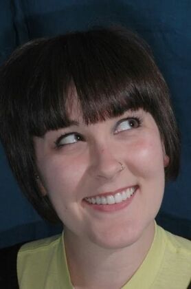 Smile Makeover: Ashlea - After