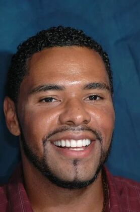 Veneers: Dale - After