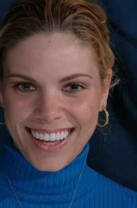 Smile Makeover: Kathy - After