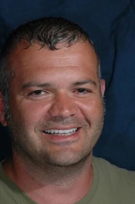 Smile Makeover: Nick 2 - After