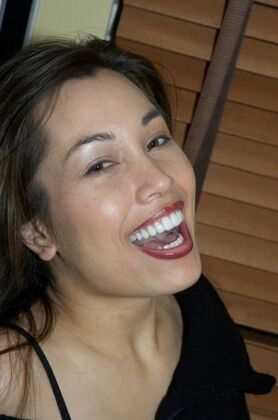 Veneers: Daniela - After