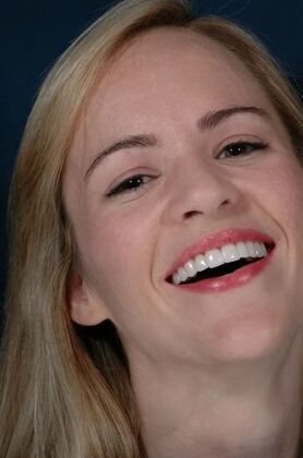 Veneers: Yvonne - After