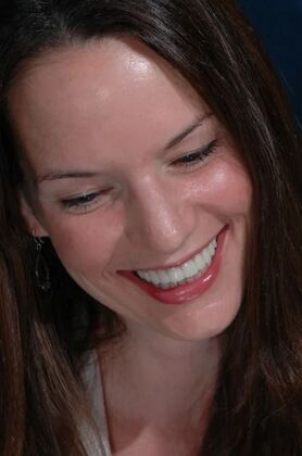 Veneers: Laura - After