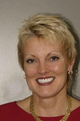 Smile Makeover: Patricia - After